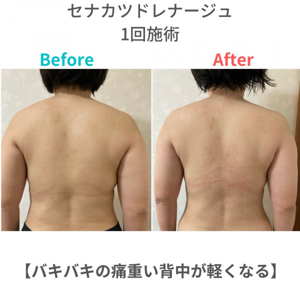 クーポン バキバキの痛重い背中が軽くなる セナカツドレナージュ Musu B むすびタウン
