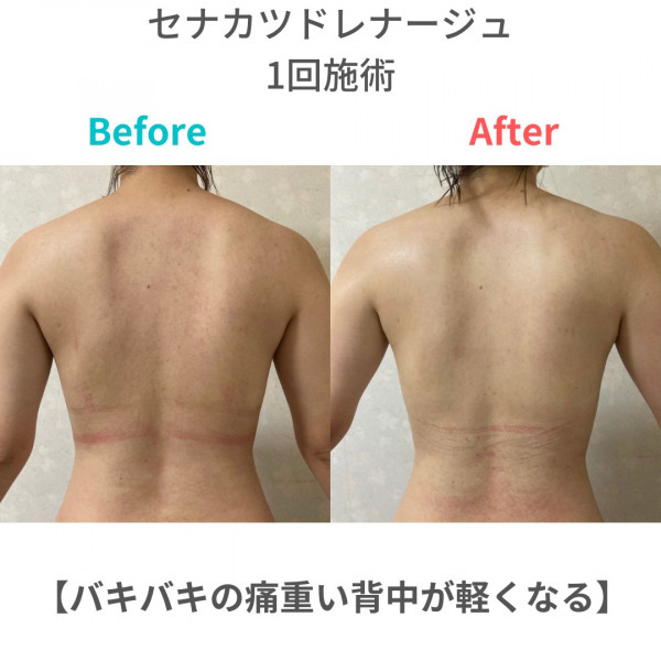 お客様のお声 ギャラリー バキバキの痛重い背中が軽くなる セナカツドレナージュ Musu B むすびタウン
