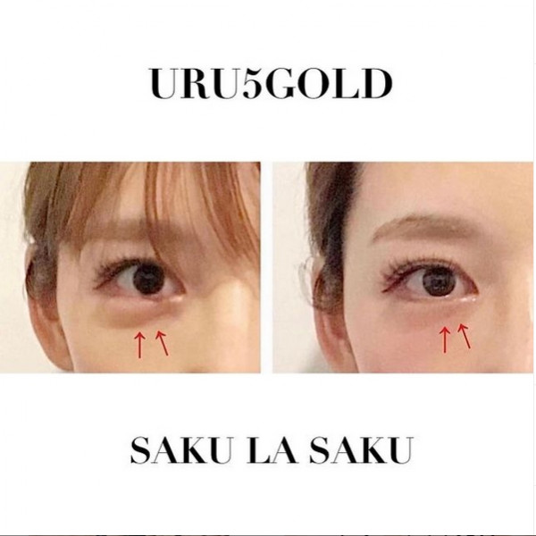 たるみ肌質改善専門サロン　SAKU LA SAKU | URU5GOLD目元集中