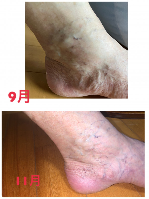 レイマージュ【女性整体・小顔矯正・体質改善】 | 下肢静脈瘤～