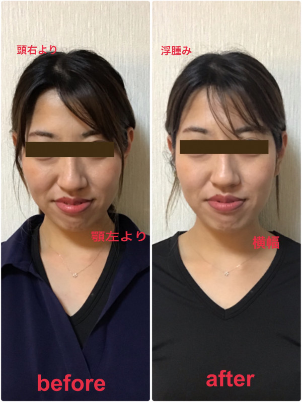 Leimaju 骨格調整 《女性限定サロン》 | 小顔調整