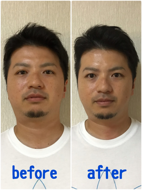 レイマージュ【女性整体・小顔矯正・体質改善】 | 小顔調整＋浮腫みリセット✨