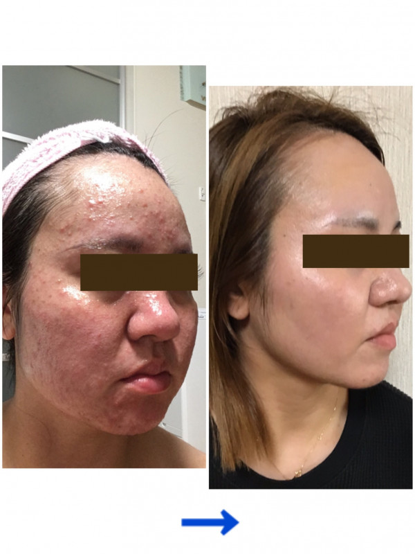 レイマージュ【女性整体・小顔矯正・体質改善】 | エステに通わず、日々のスキンケアで肌荒れ改善✨