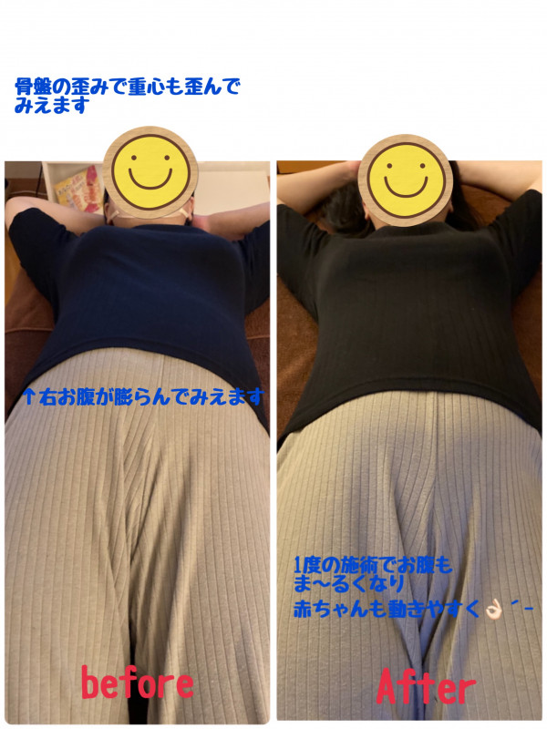 レイマージュ【女性整体・小顔矯正・体質改善】 | 骨盤の歪みは、皆さんこういう風にあるかも？？