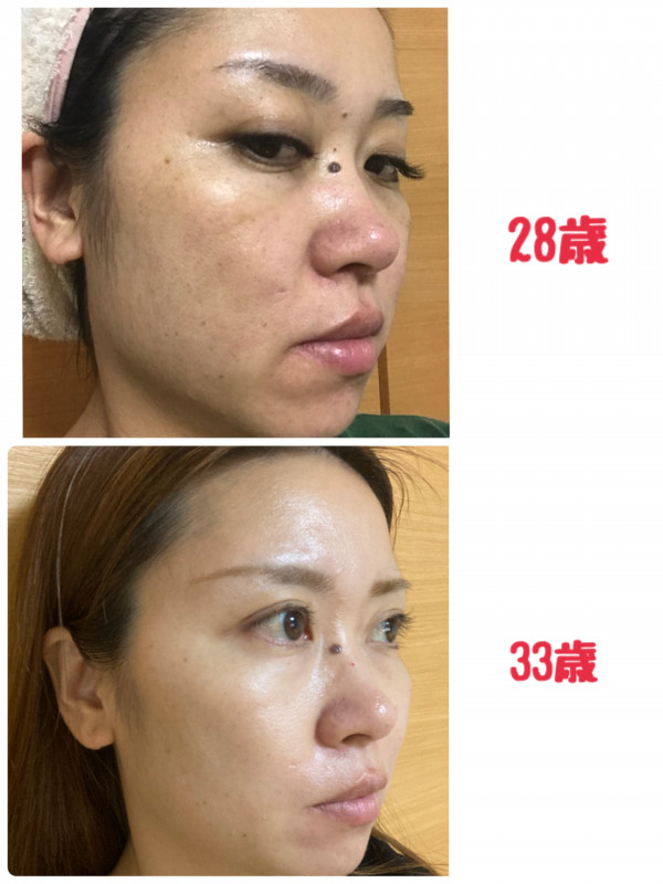 レイマージュ【女性整体・小顔矯正・体質改善】 | 歳をとるごとに綺麗になる素肌~✨