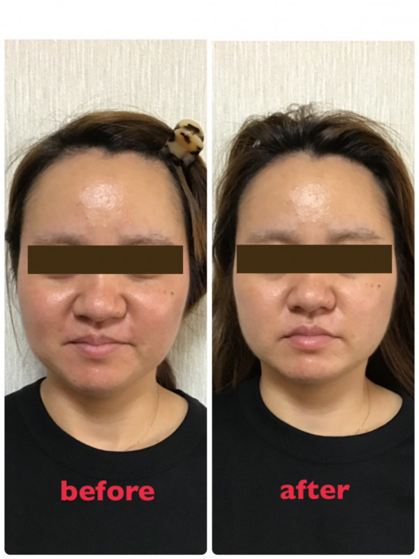 レイマージュ【女性整体・小顔矯正・体質改善】 | ビフォーアフター