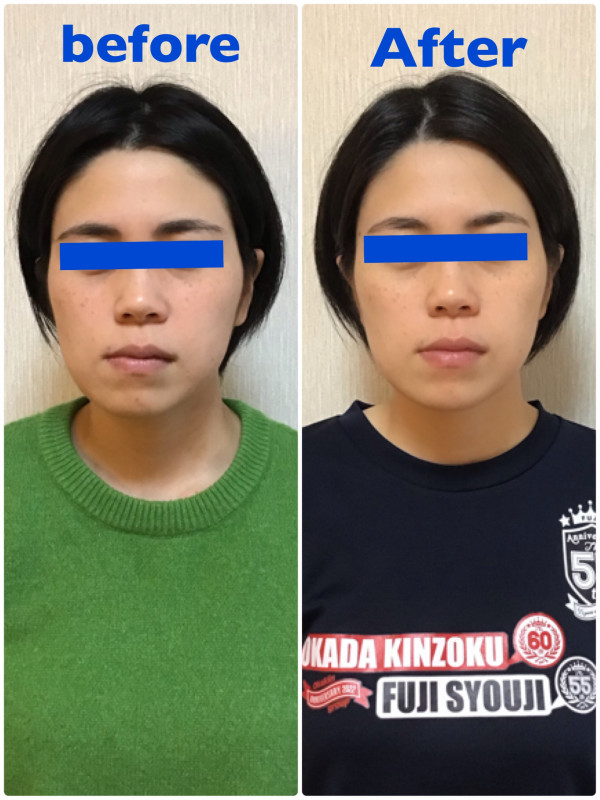 レイマージュ【女性整体・小顔矯正・体質改善】 | お顔の歪みは諦めないで下さい❁¨̮