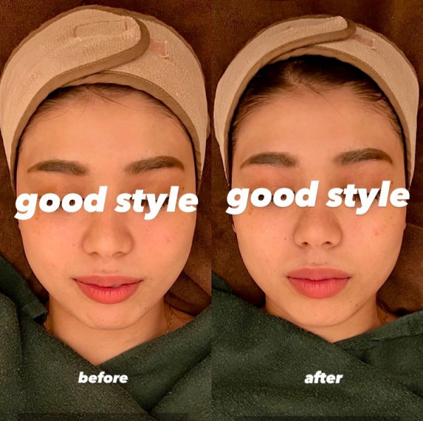 SALON  DE  GOOD  STYLE《都度払い痩身・ハイフ専門店》 | before→after