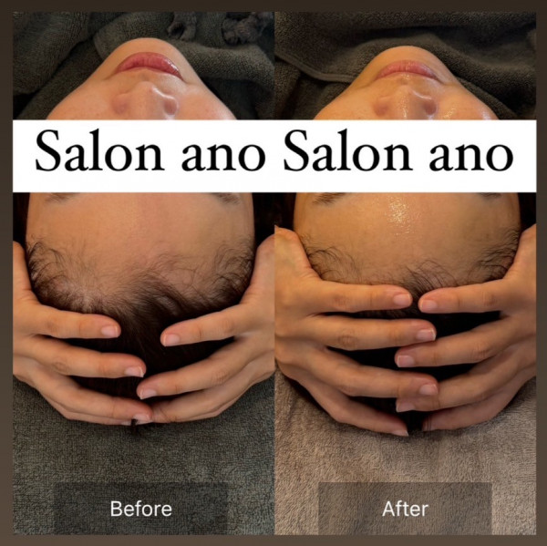 Salon ano | 脳洗浄®︎フルコース