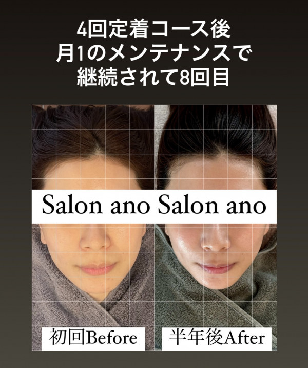 Salon ano | 脳洗浄®︎フルコース