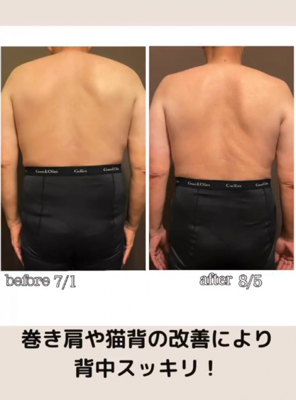 エステ・フランセスルーム | 【痩身】メニュー キャビテーション