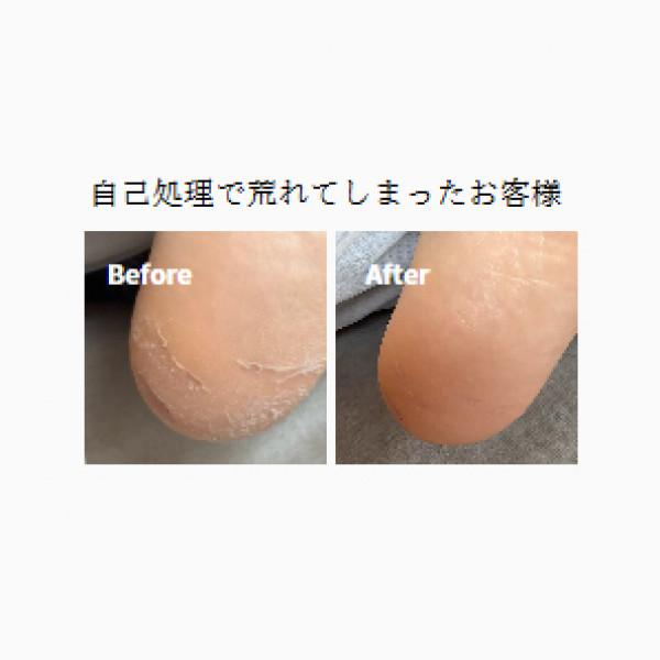 karahisa (カラヒサ)【フットケア専門店】 | 