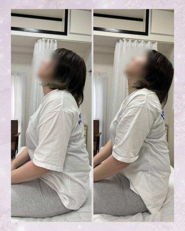 Lean on　～リーンオン～ | Before→After3