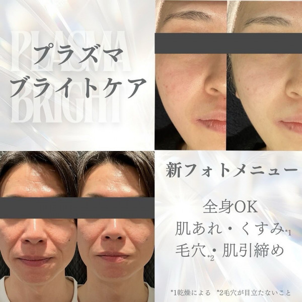 Churara | プラズマブライトケア