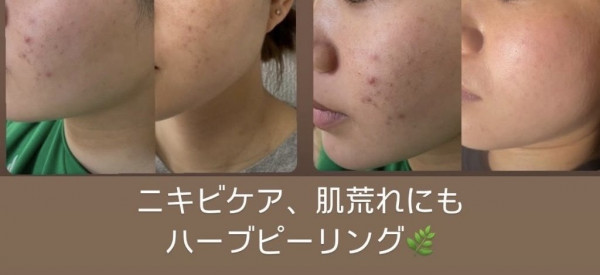 Beauty salon プルメリア | 