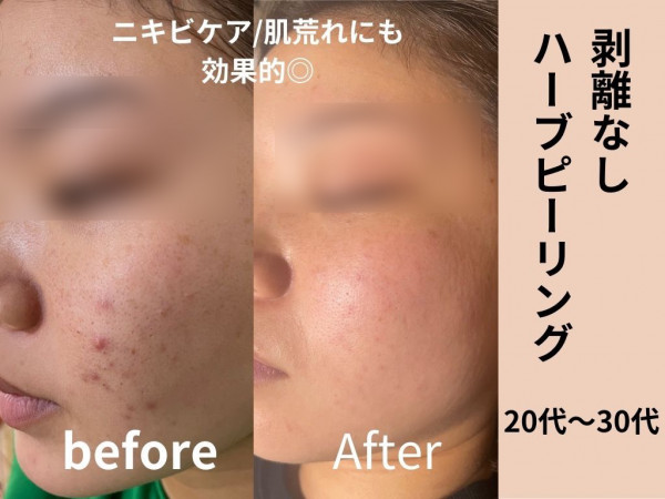 Beauty salon プルメリア | 