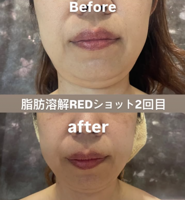 Beauty salon プルメリア | 